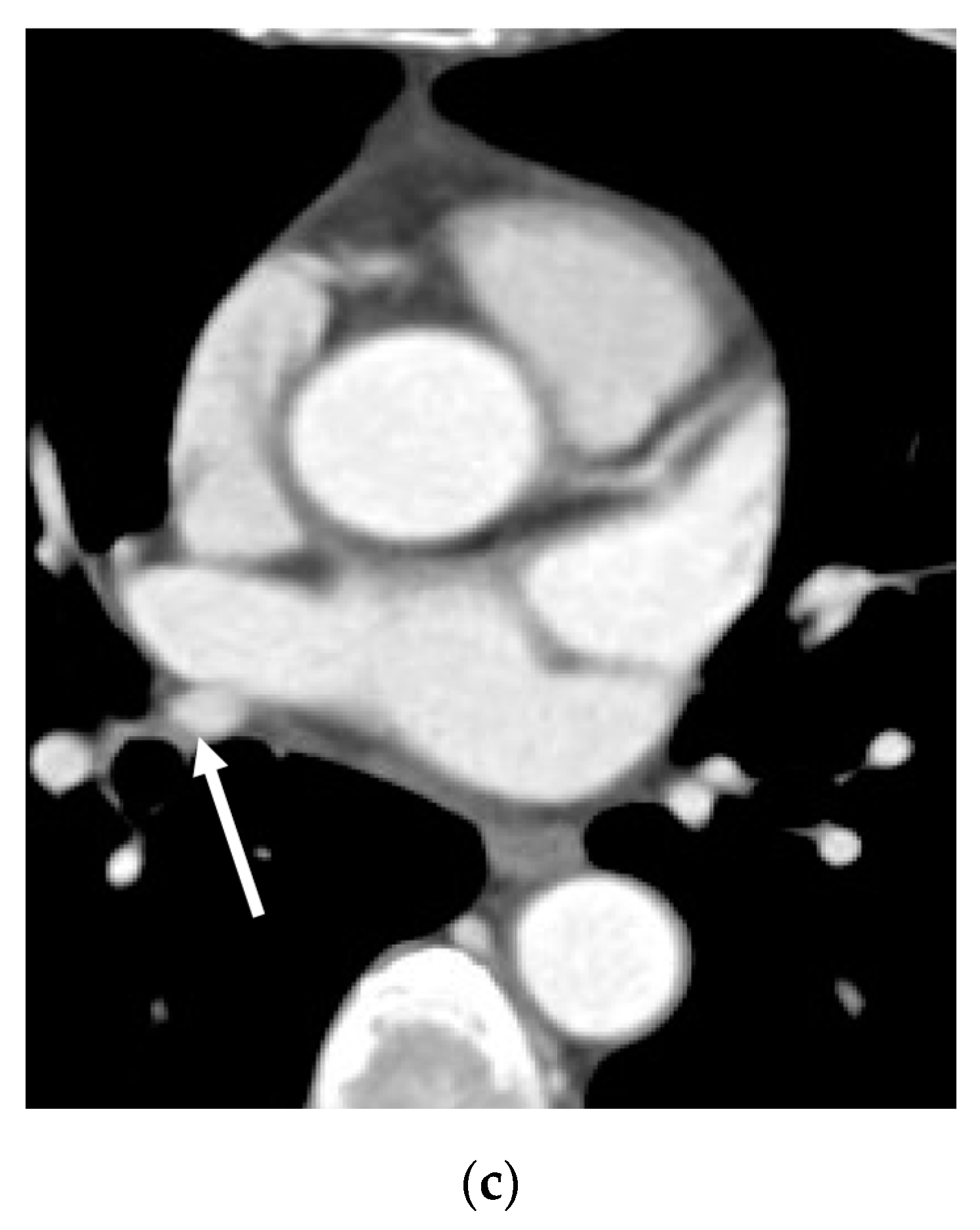 Diagnostics 13 02744 g002b