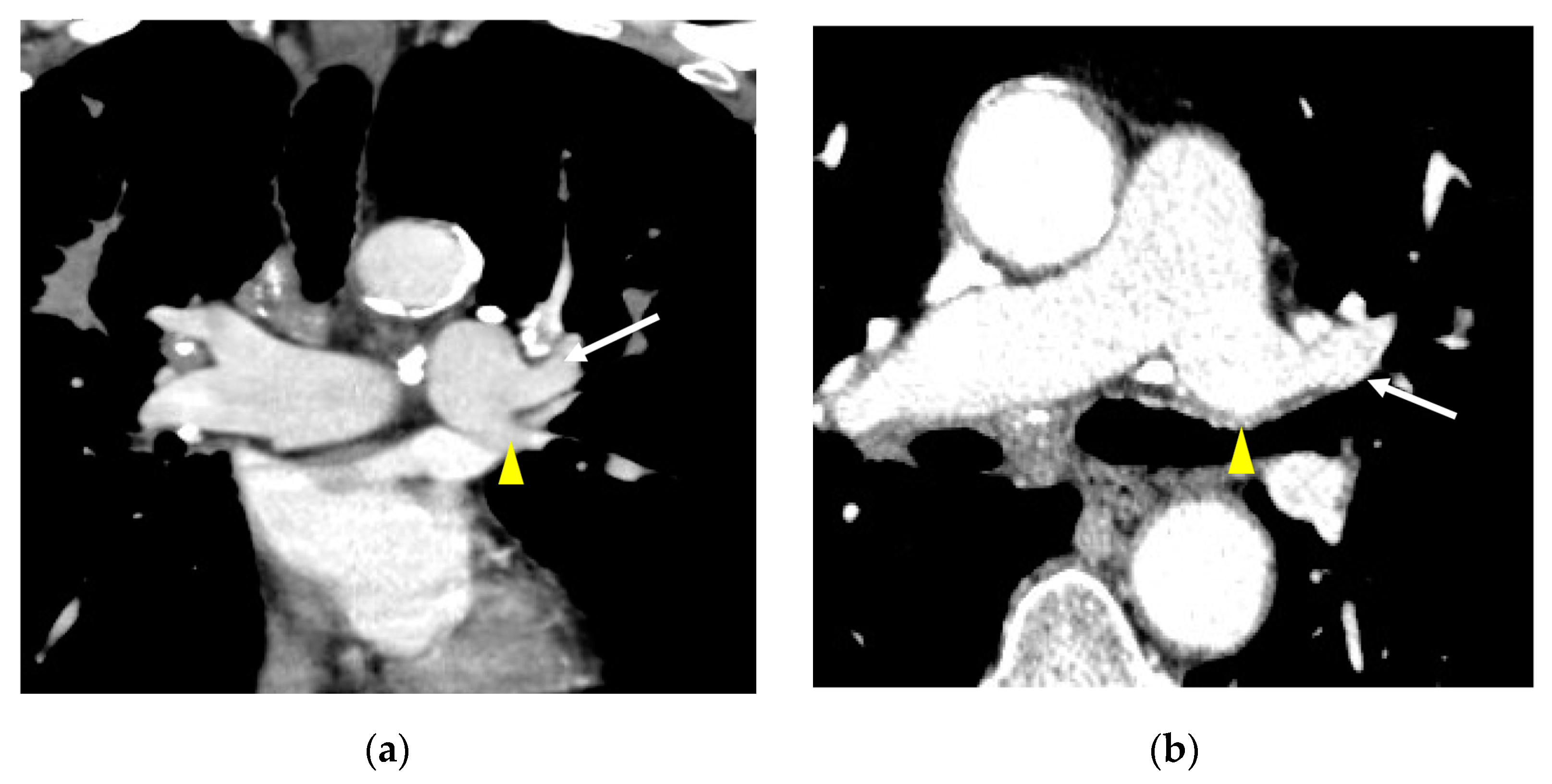 Diagnostics 13 02744 g003a