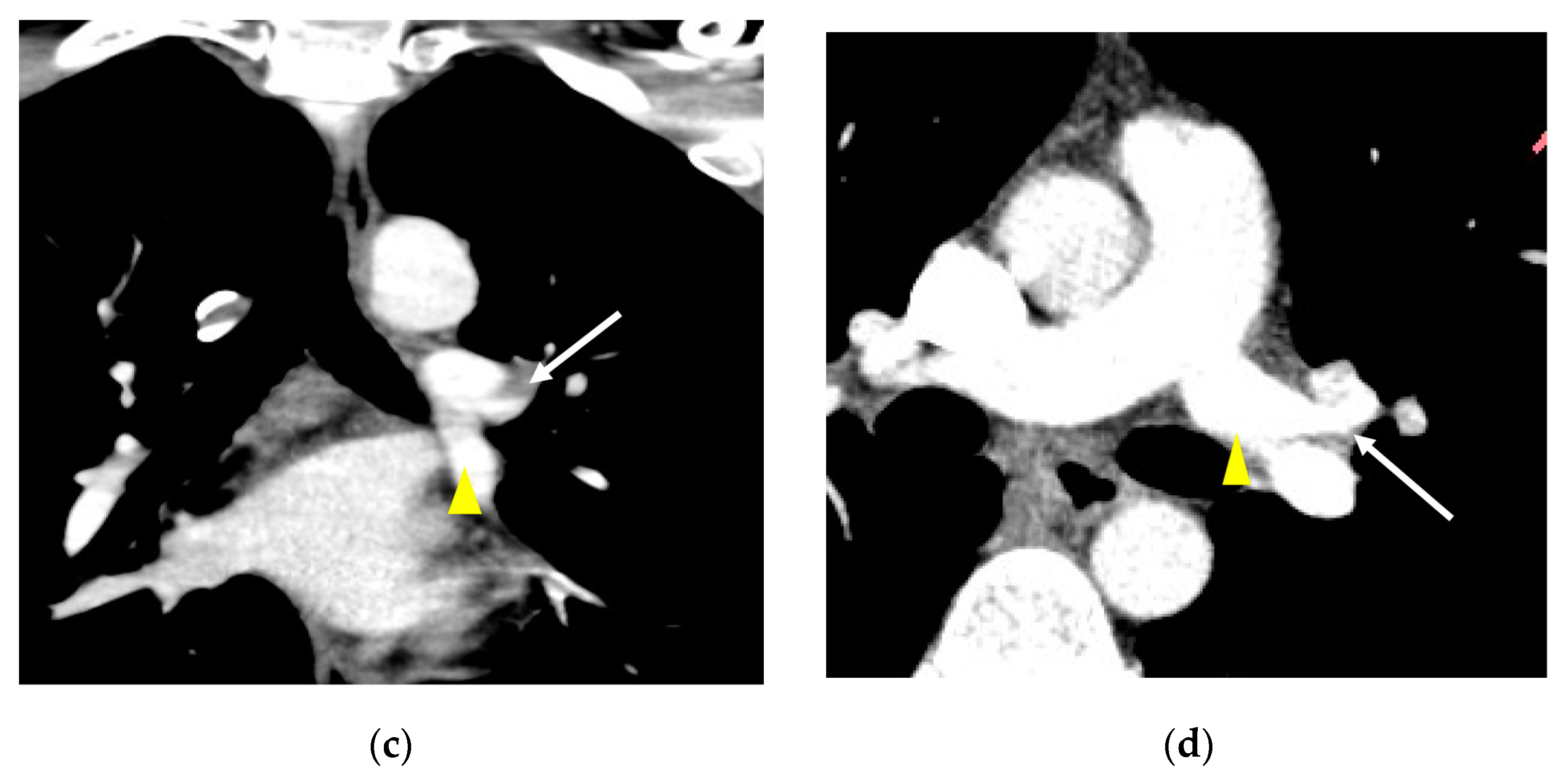 Diagnostics 13 02744 g003b