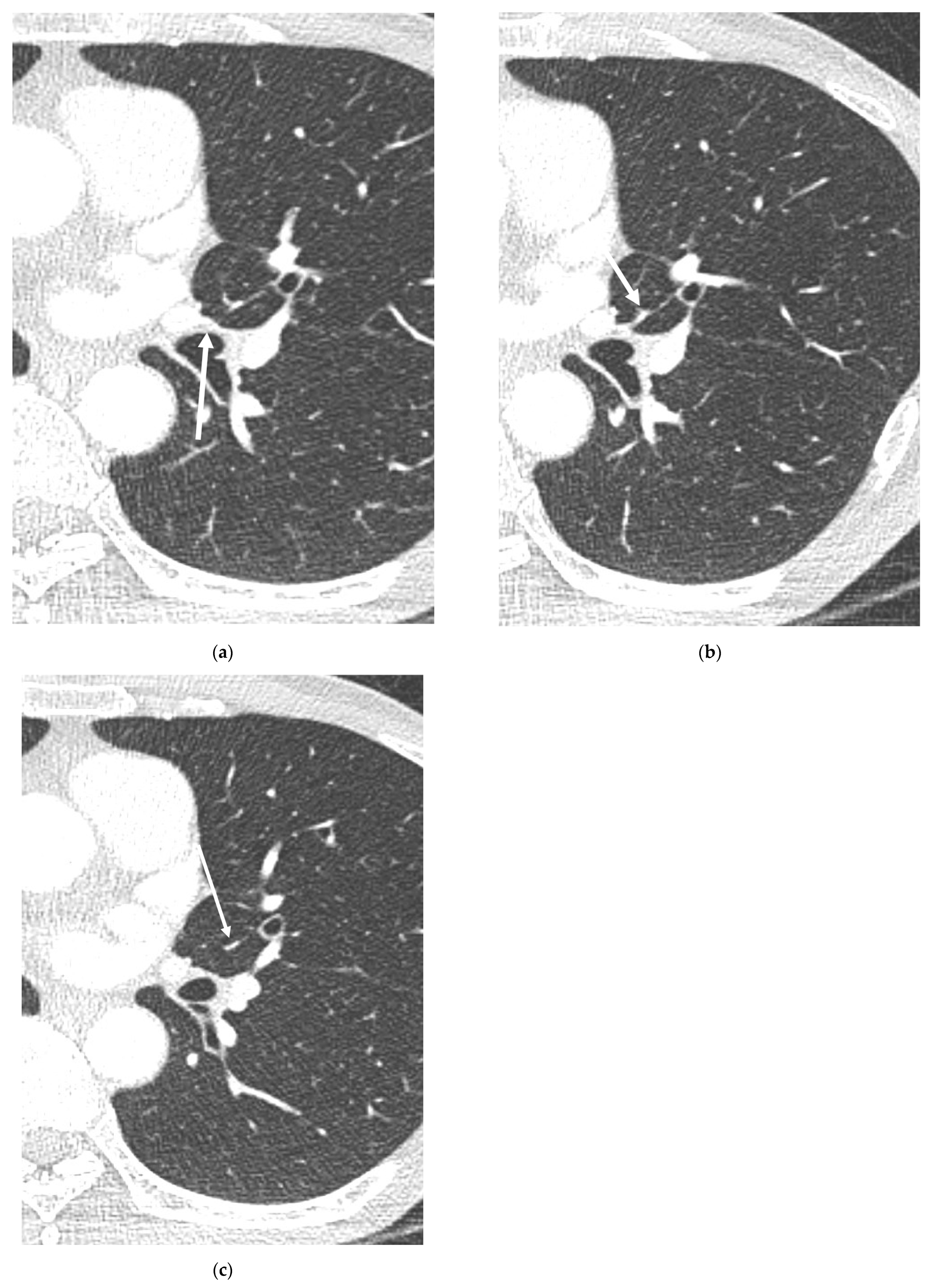 Diagnostics 13 02744 g004