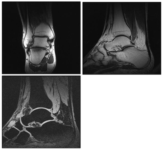 Diagnostics 13 02750 g0a4