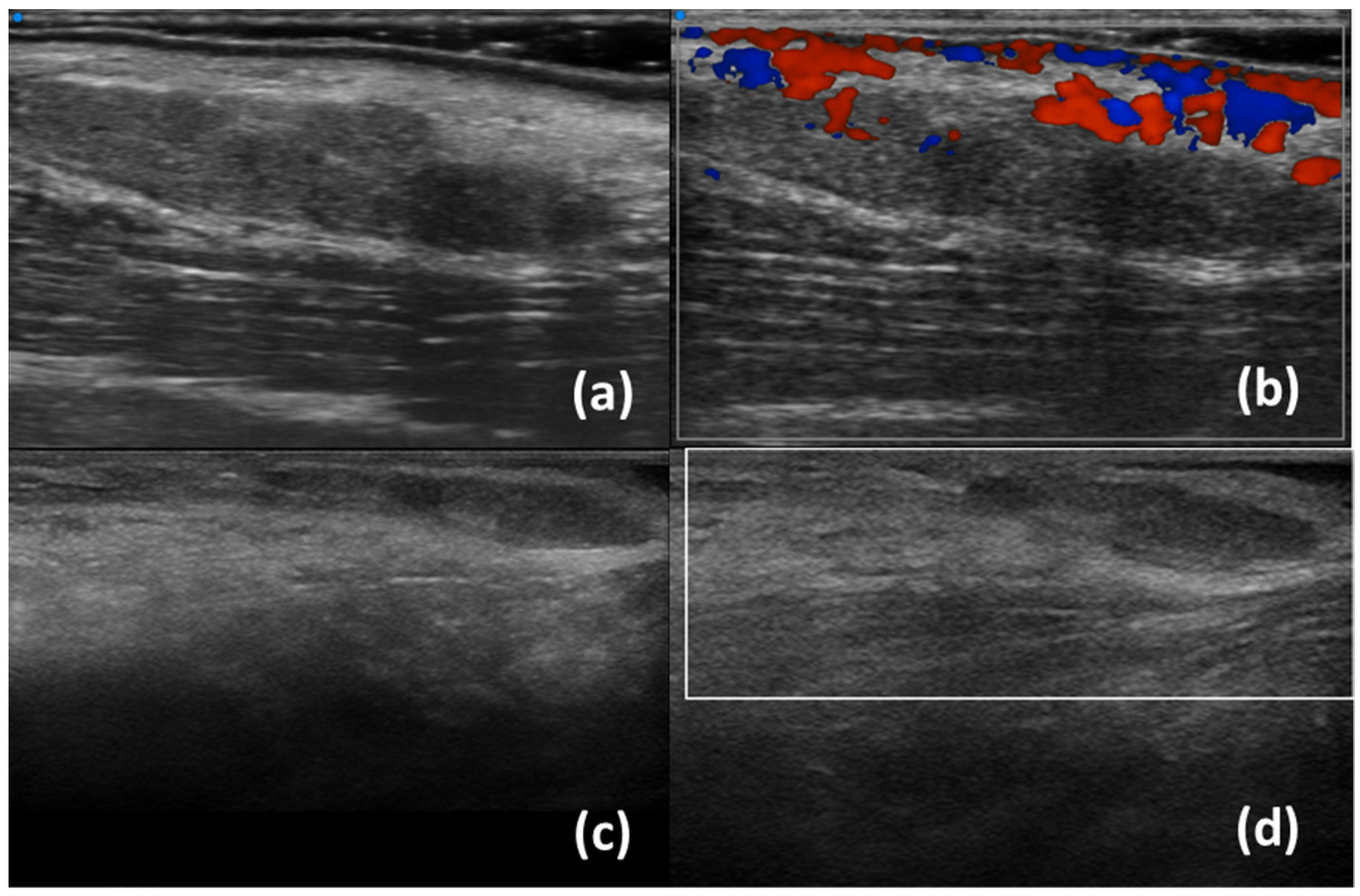 Diagnostics 13 02771 g003