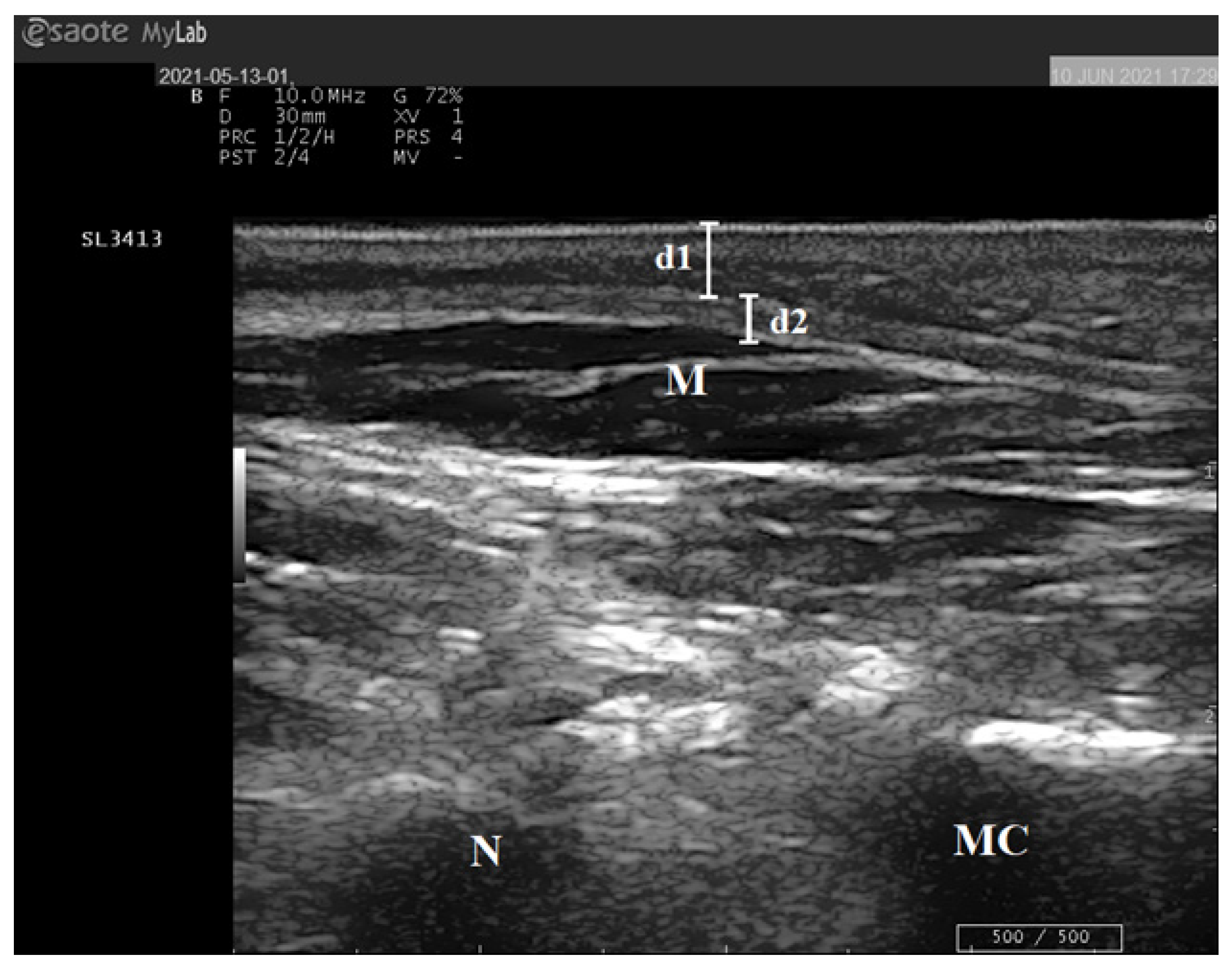 Diagnostics 13 02781 g001