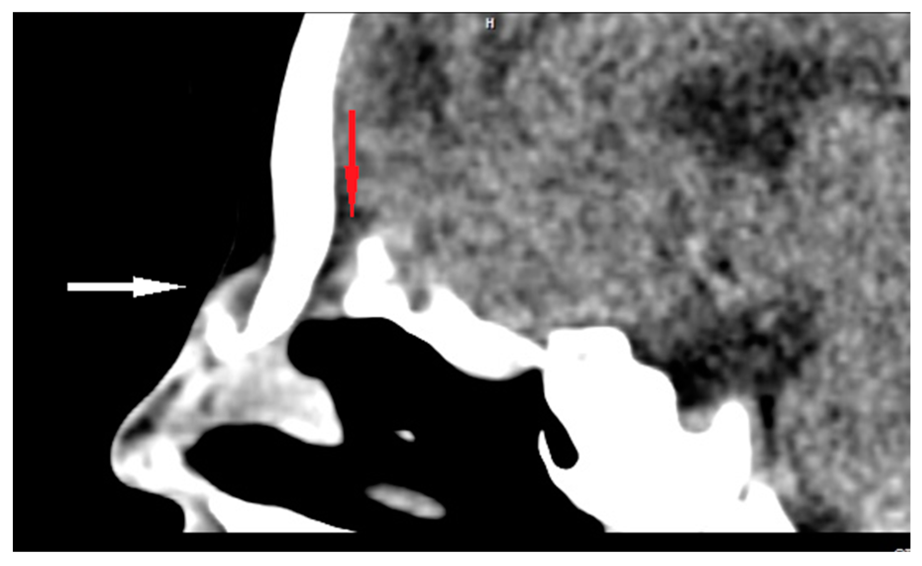 Diagnostics 13 02796 g004