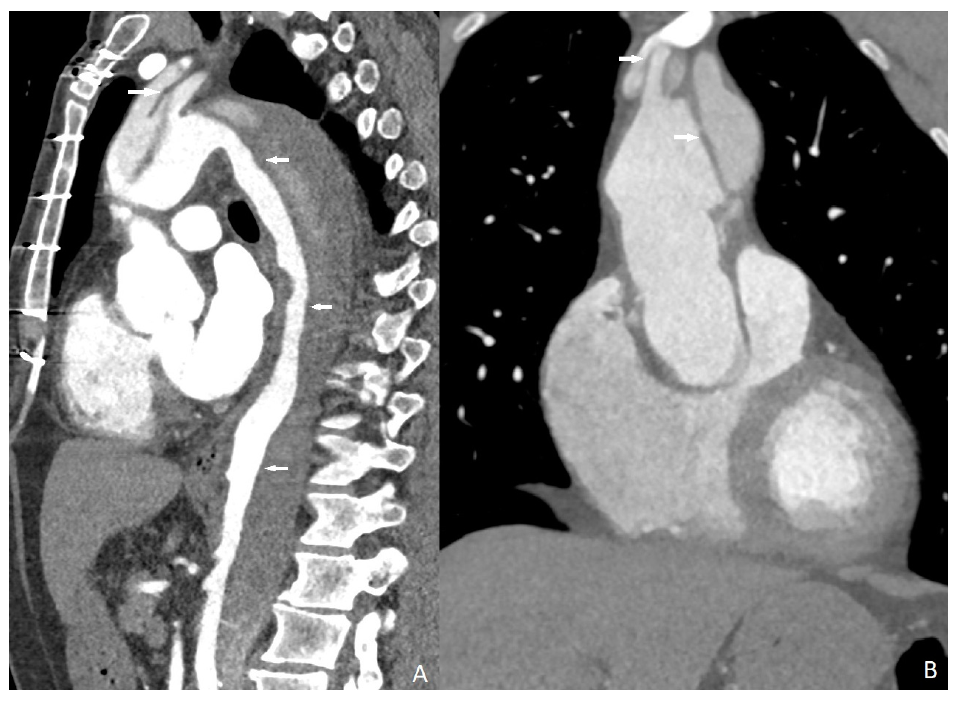 Diagnostics 13 02799 g004