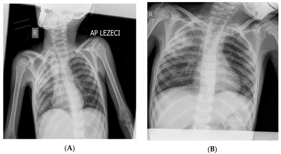 Diagnostics 13 02826 g001