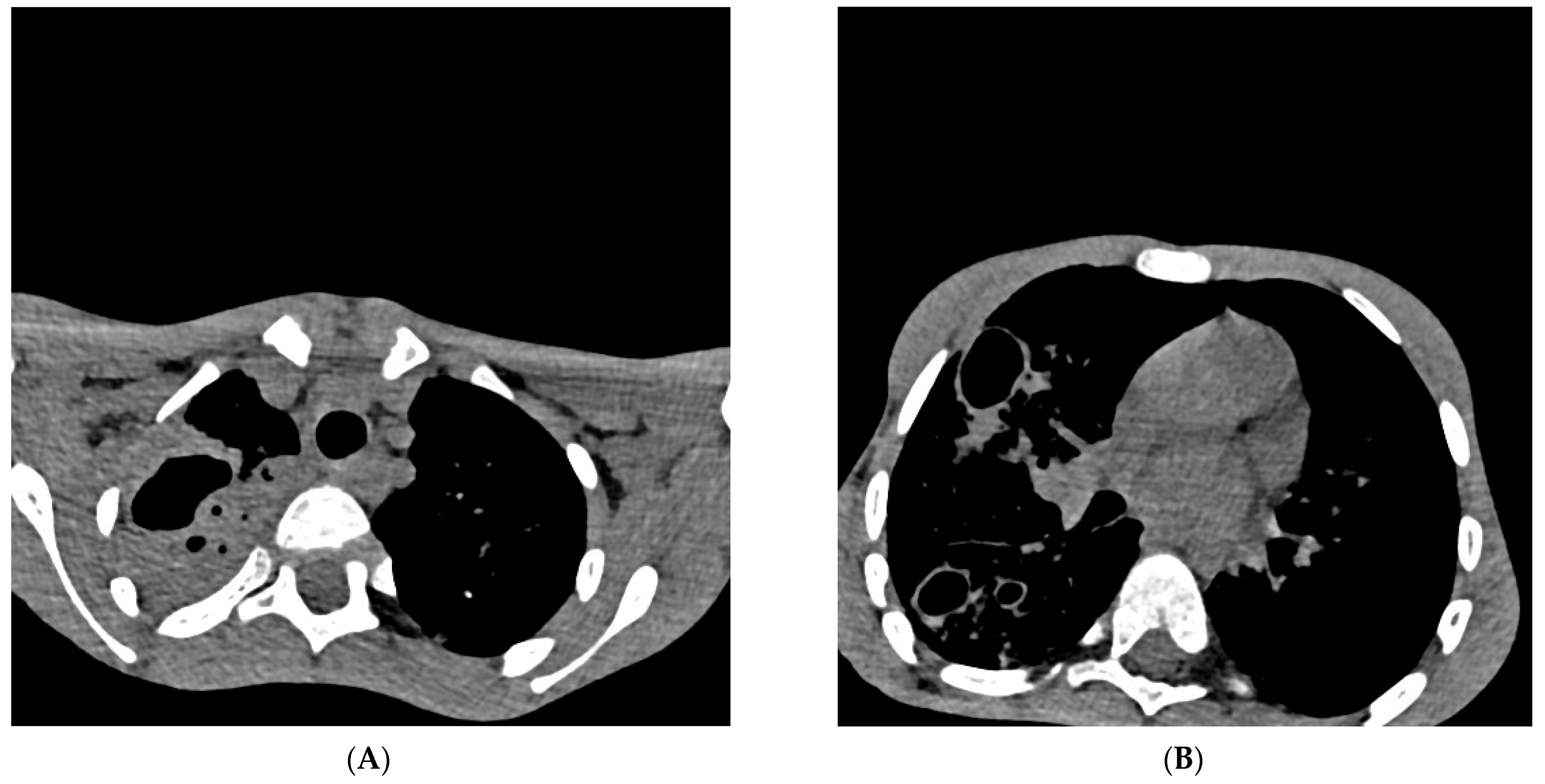 Diagnostics 13 02826 g002