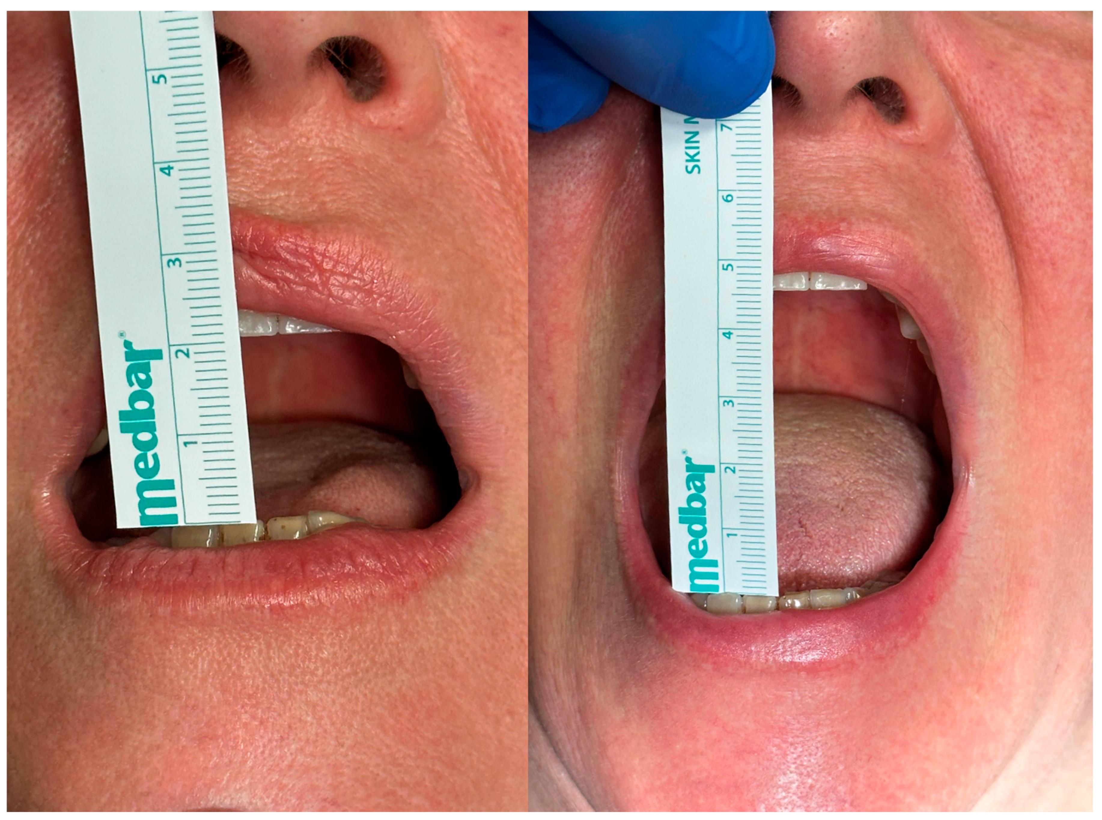 Diagnostics 13 02837 g011