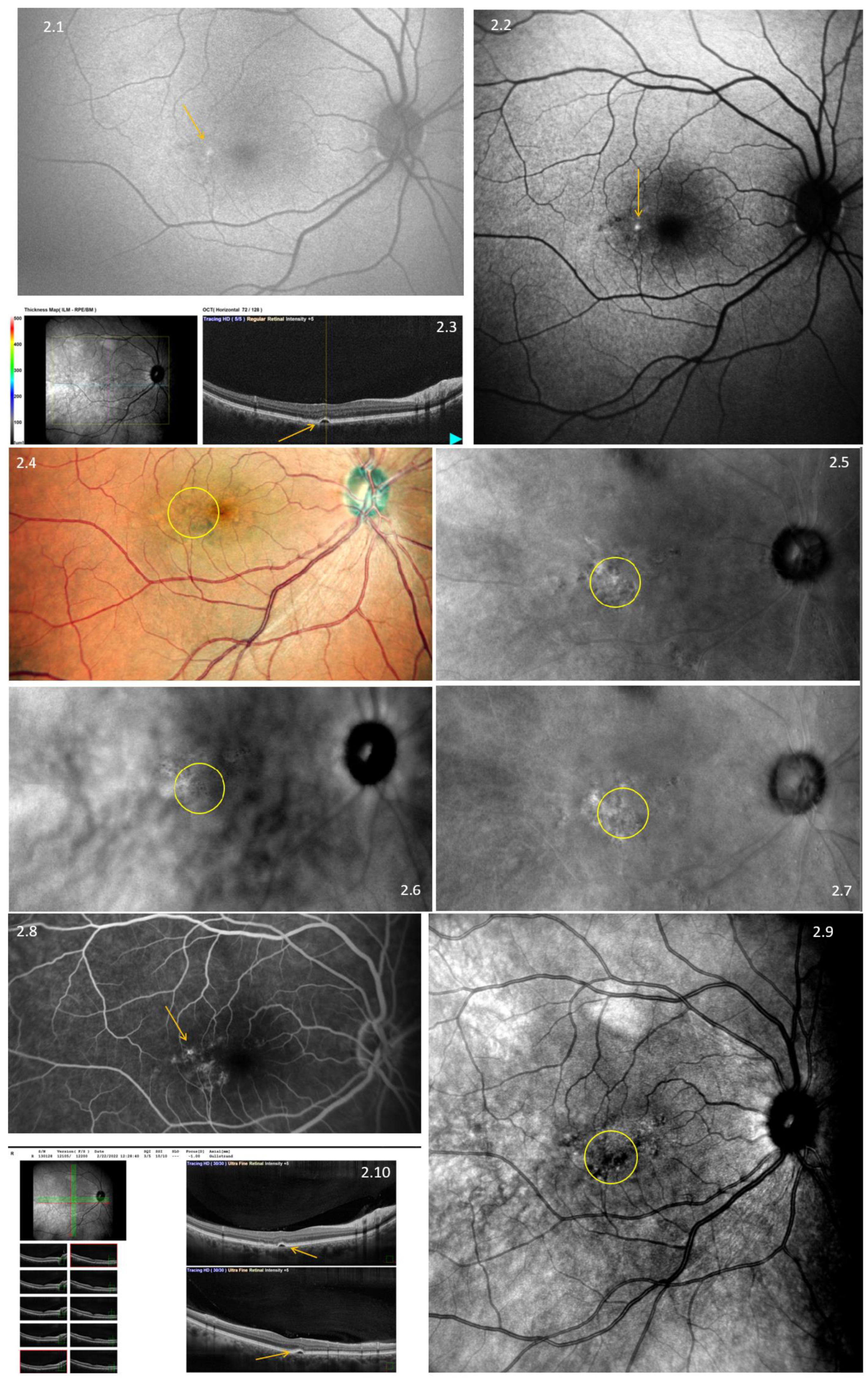 Diagnostics 13 02846 g002