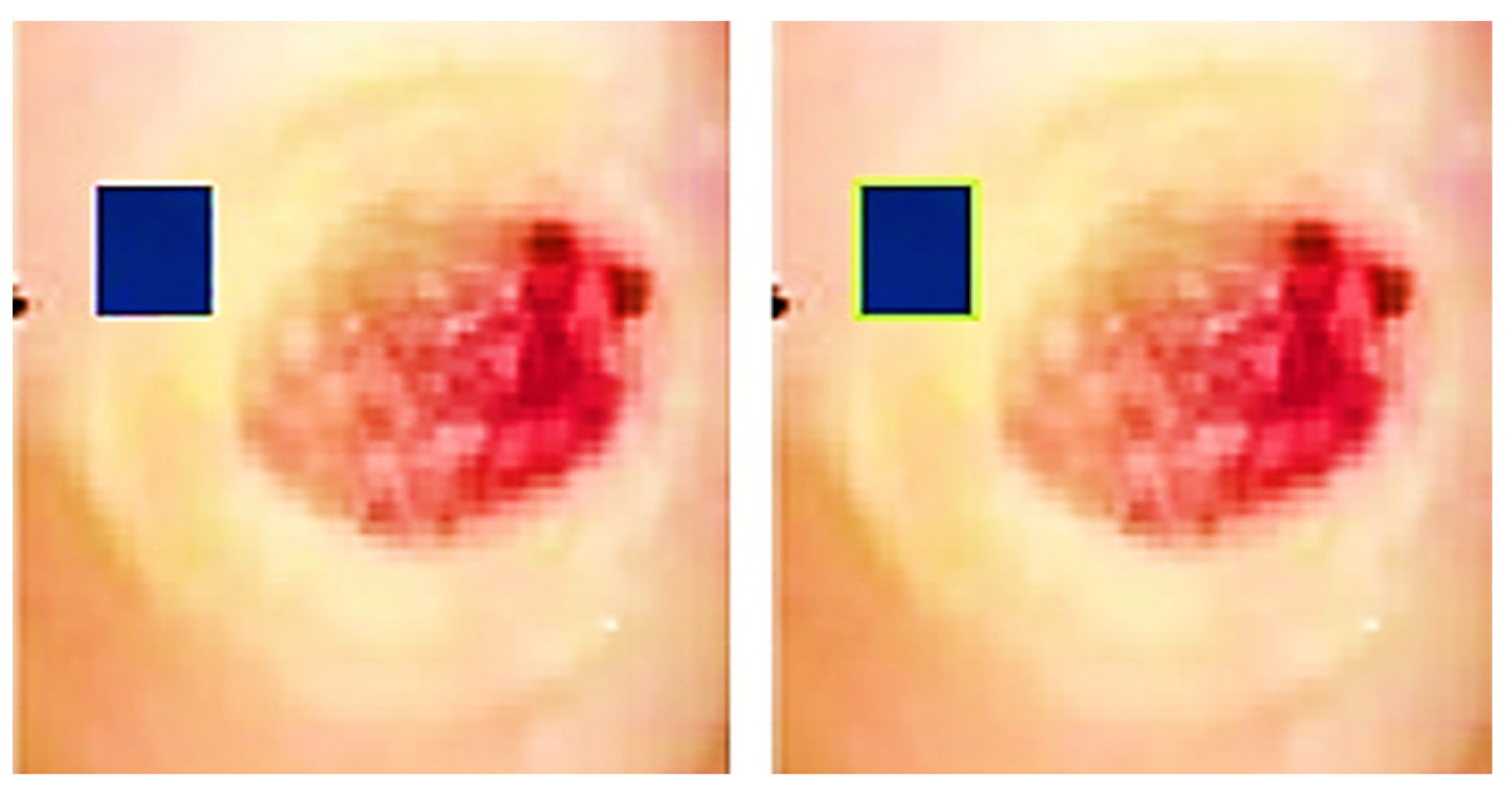 Diagnostics 13 02866 g004