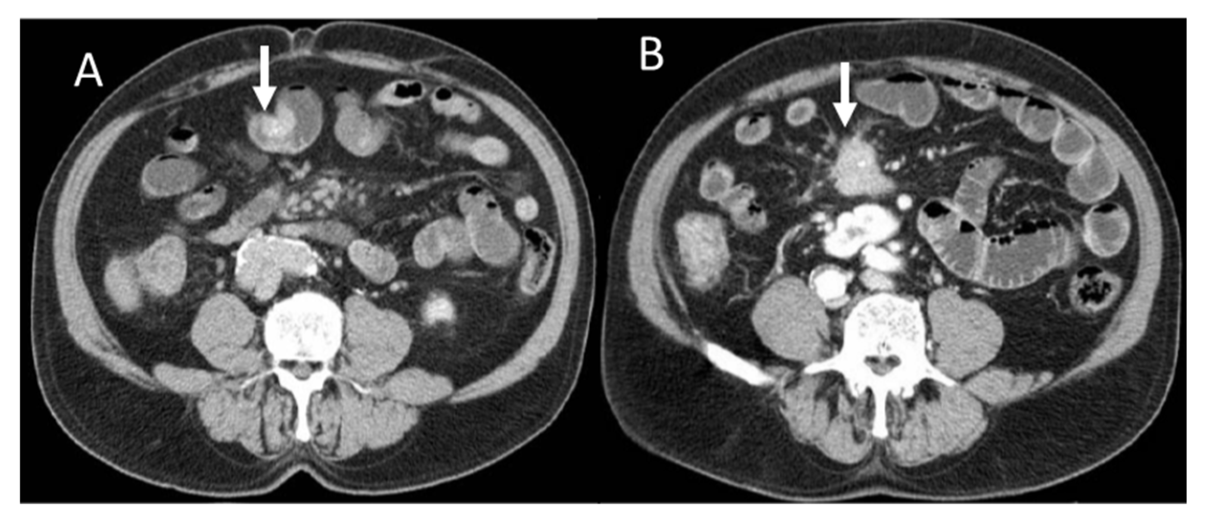 Diagnostics 13 02877 g001