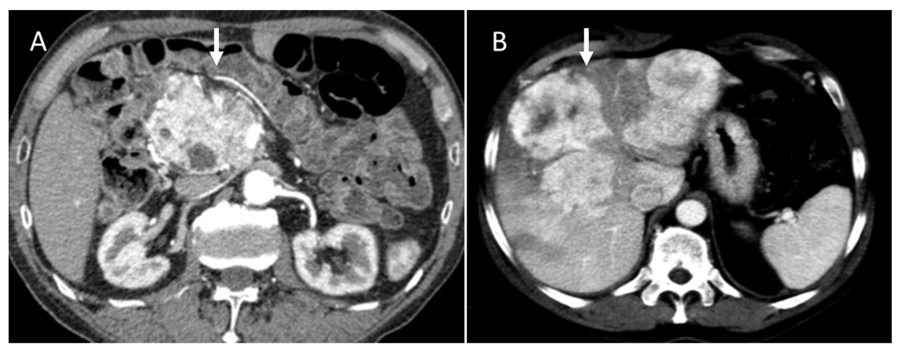 Diagnostics 13 02877 g003