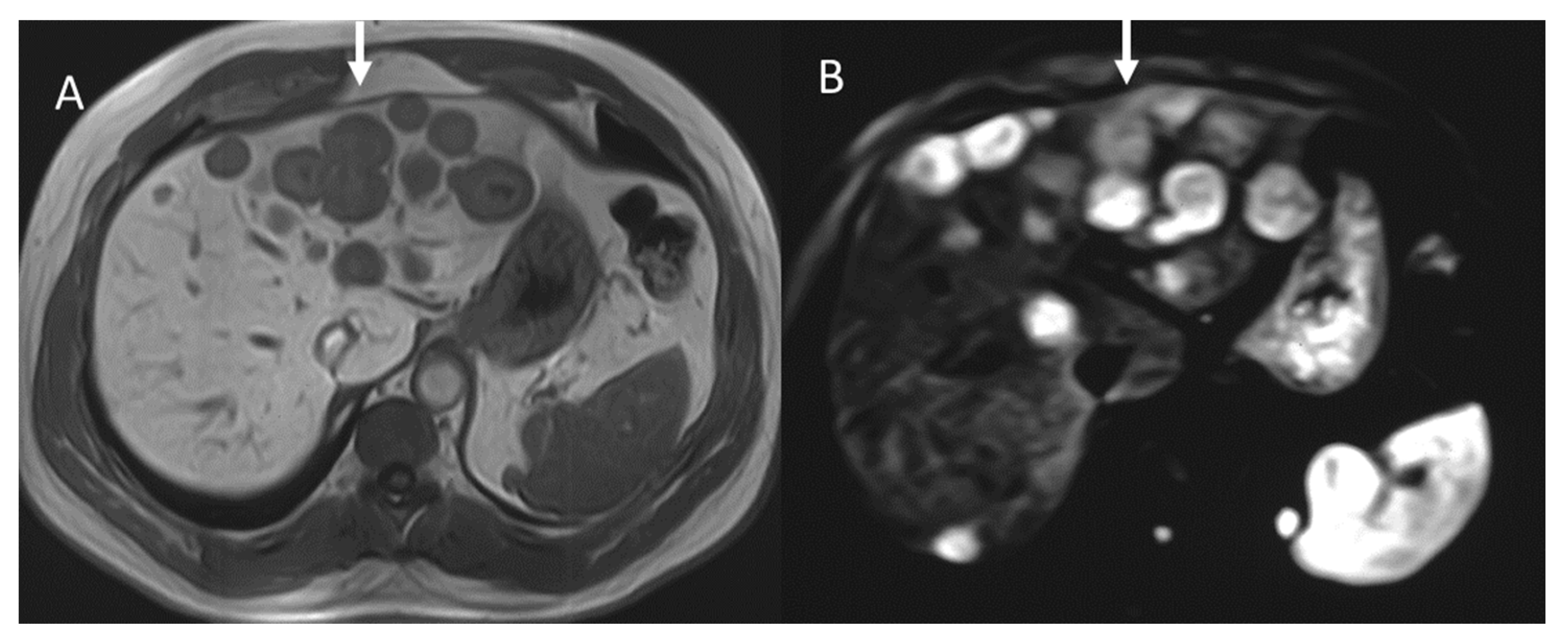 Diagnostics 13 02877 g005