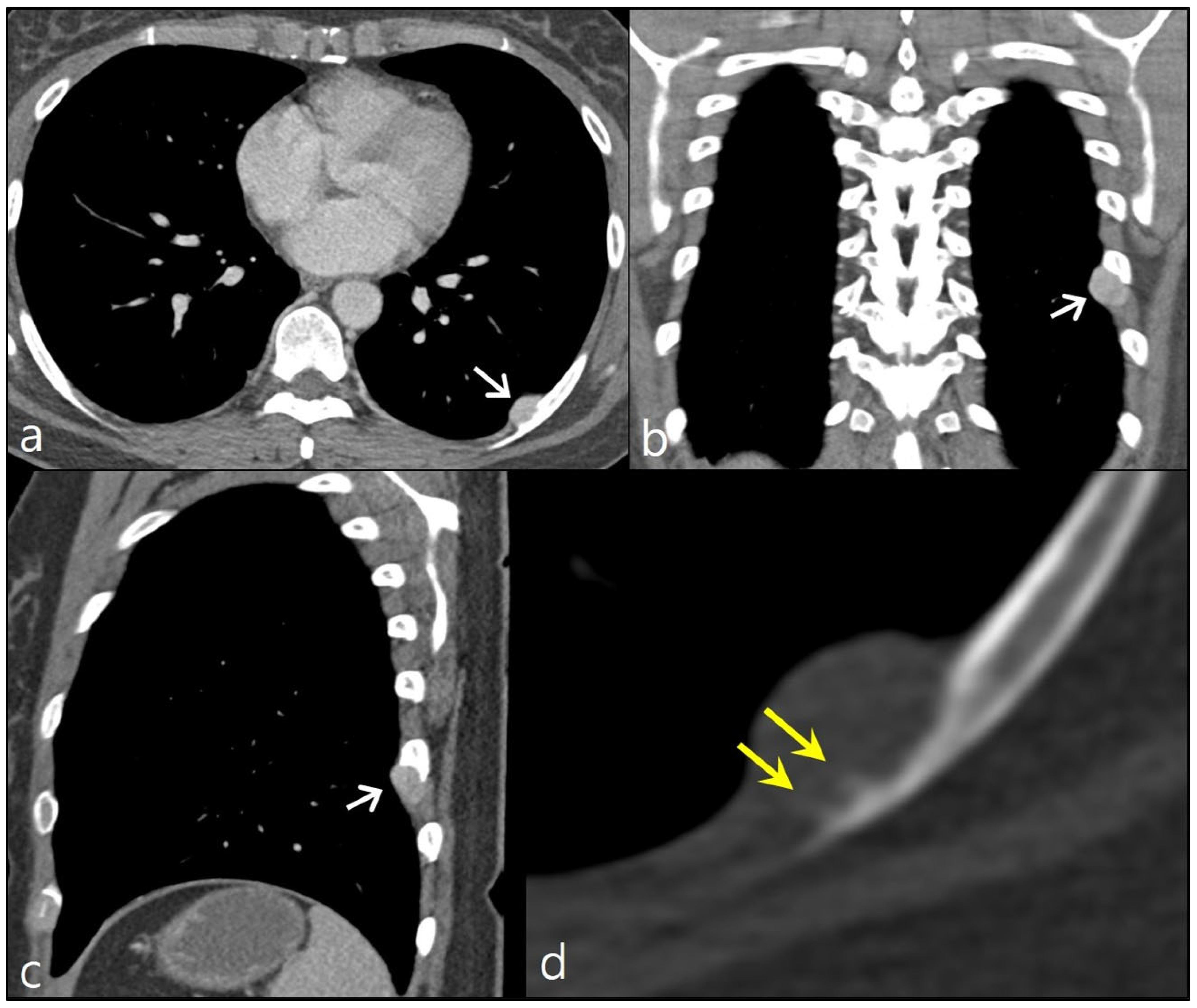 Diagnostics 13 02880 g001