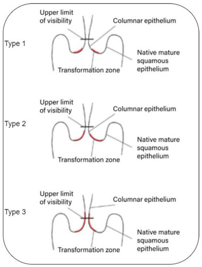 Diagnostics 13 02884 g001