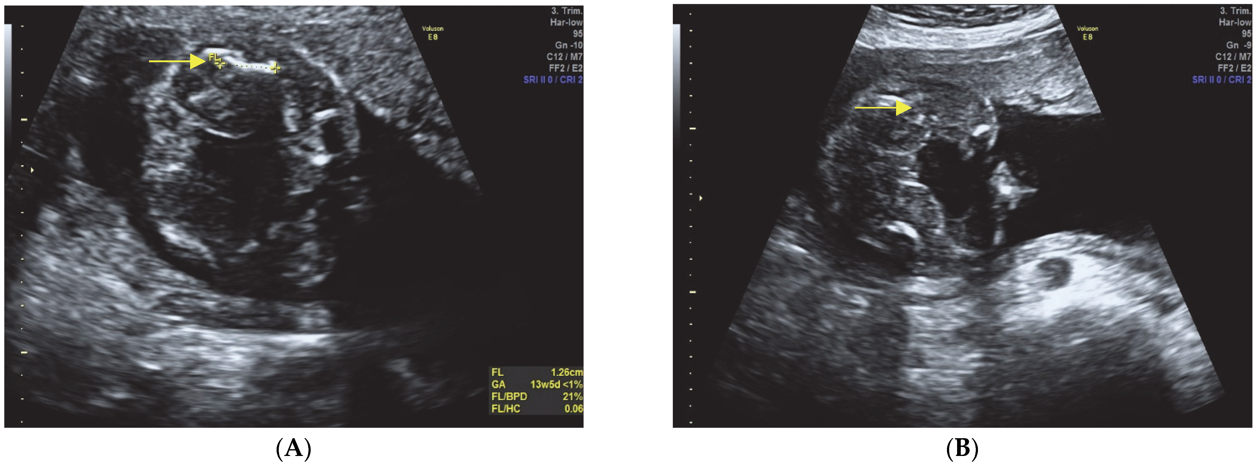 Diagnostics 13 02905 g001