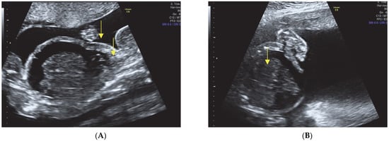 Diagnostics 13 02905 g003