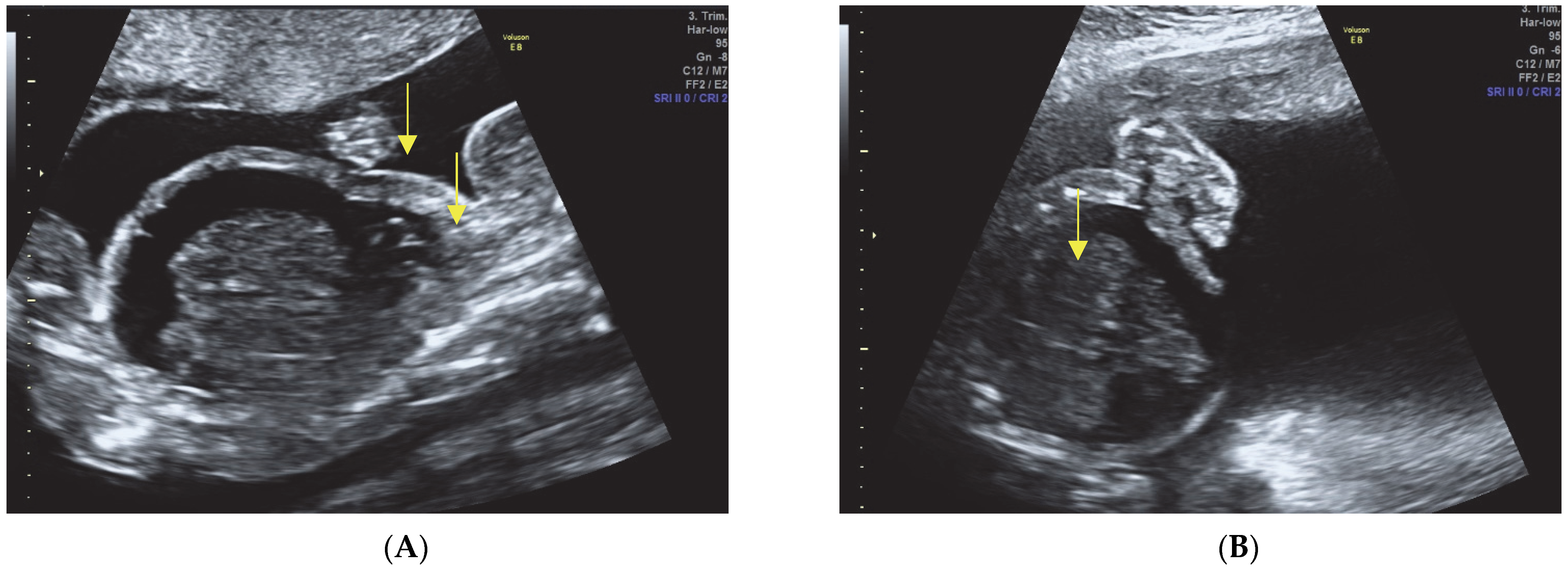 Diagnostics 13 02905 g003