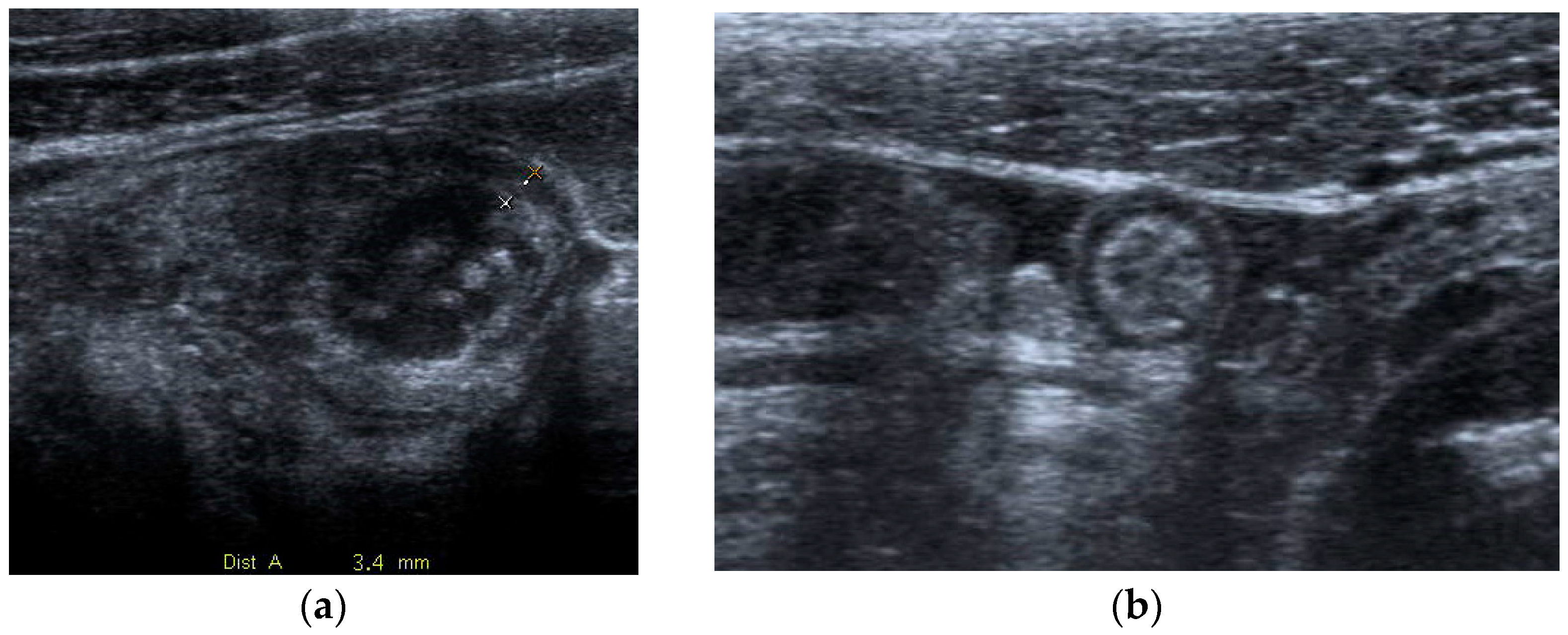 Diagnostics 13 02909 g001