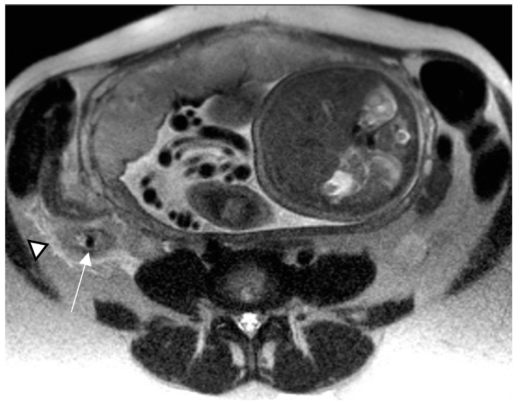 Diagnostics 13 02909 g002