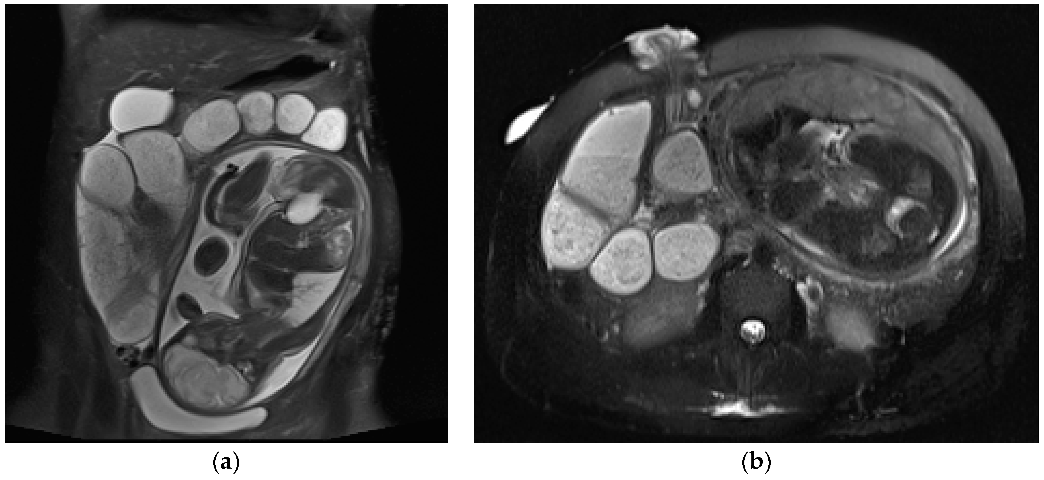 Diagnostics 13 02909 g003