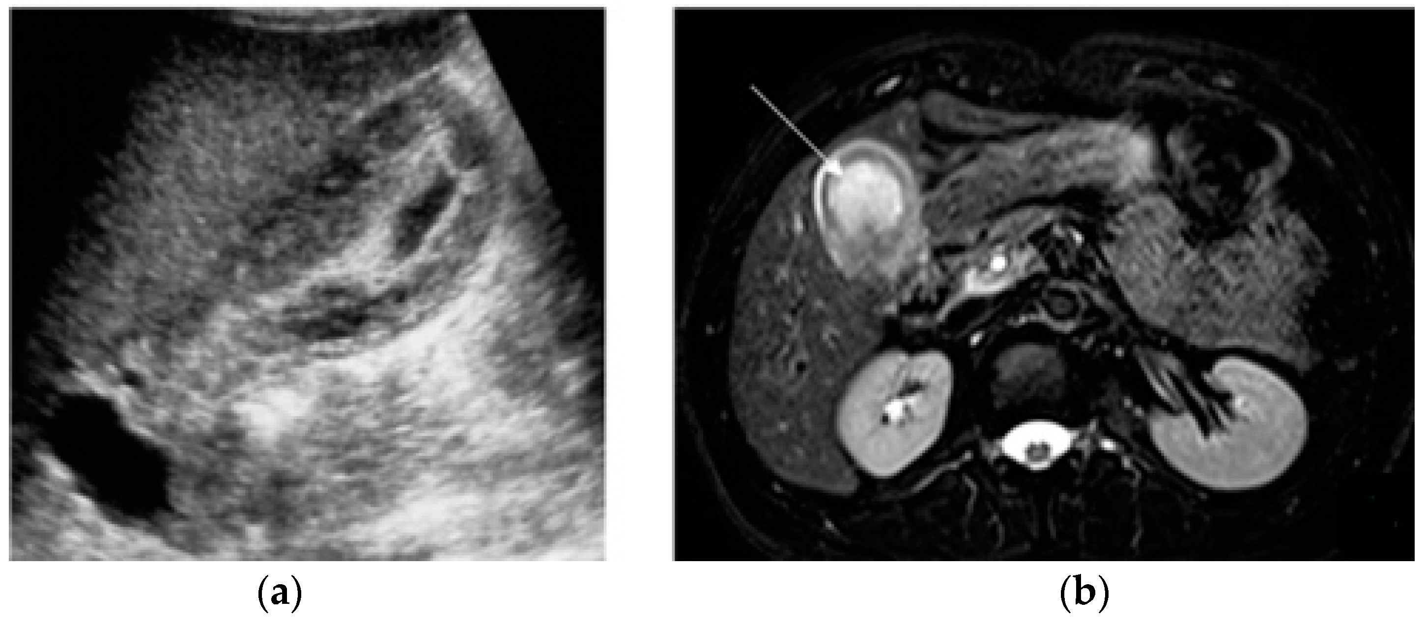 Diagnostics 13 02909 g005