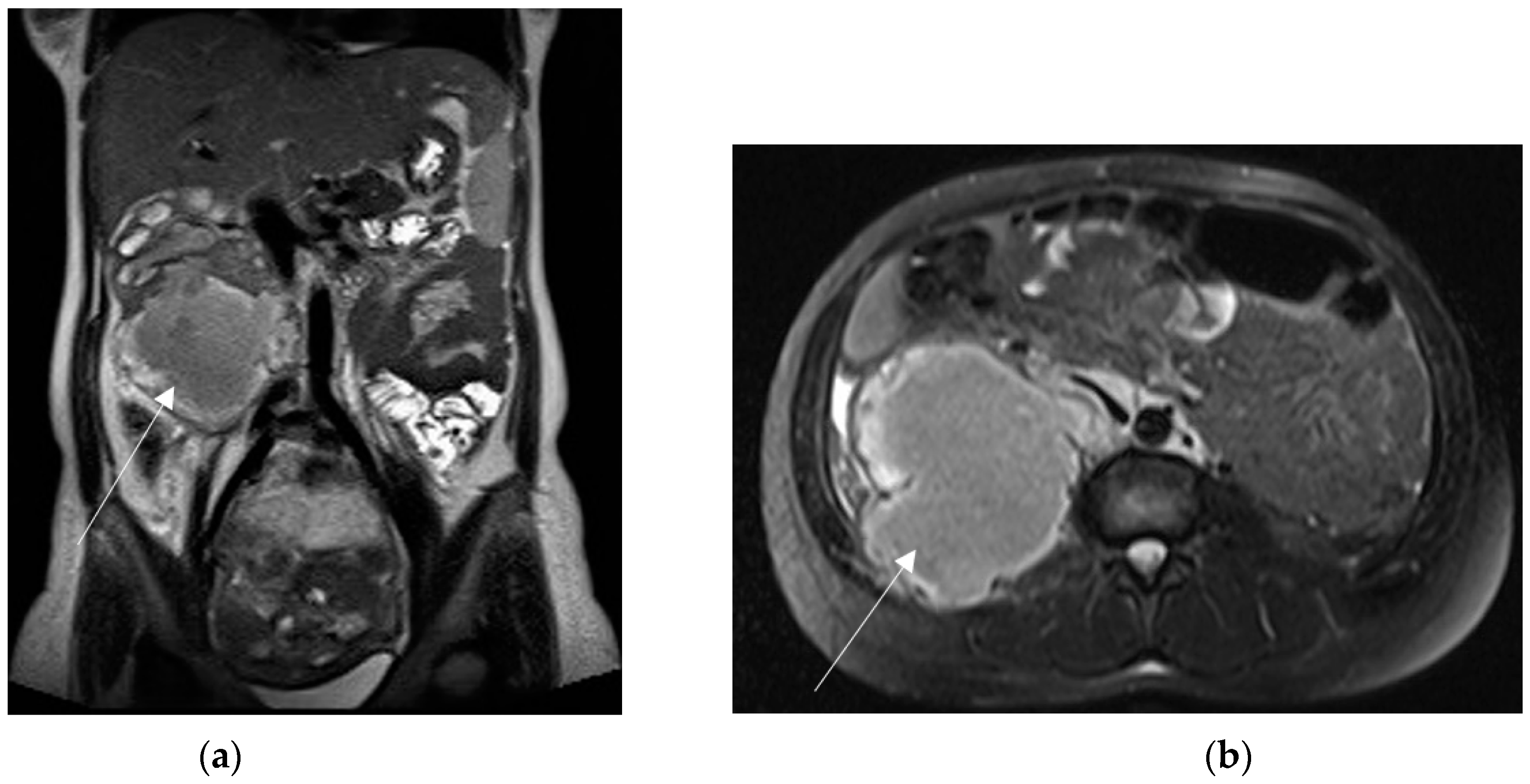 Diagnostics 13 02909 g008