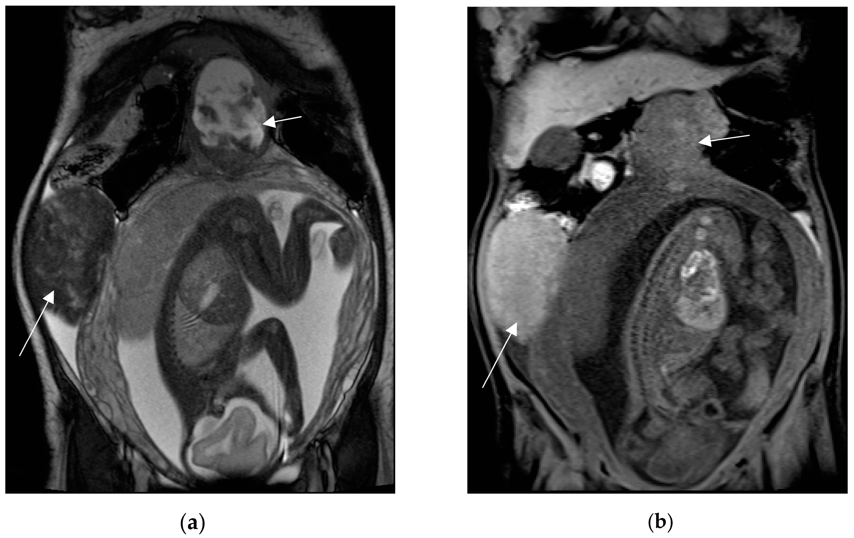 Diagnostics 13 02909 g010