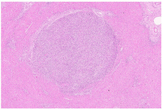 Diagnostics 13 02916 g001