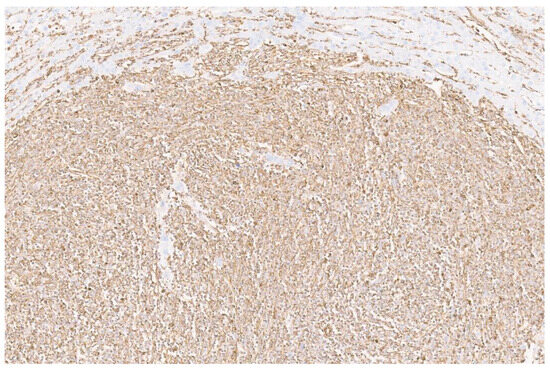 Diagnostics 13 02916 g003