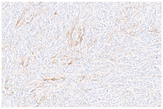 Diagnostics 13 02916 g004