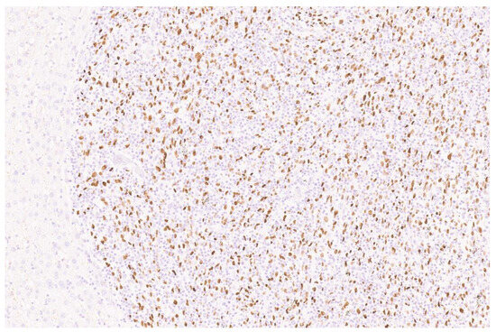 Diagnostics 13 02916 g005