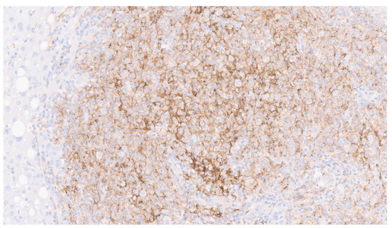 Diagnostics 13 02916 g006