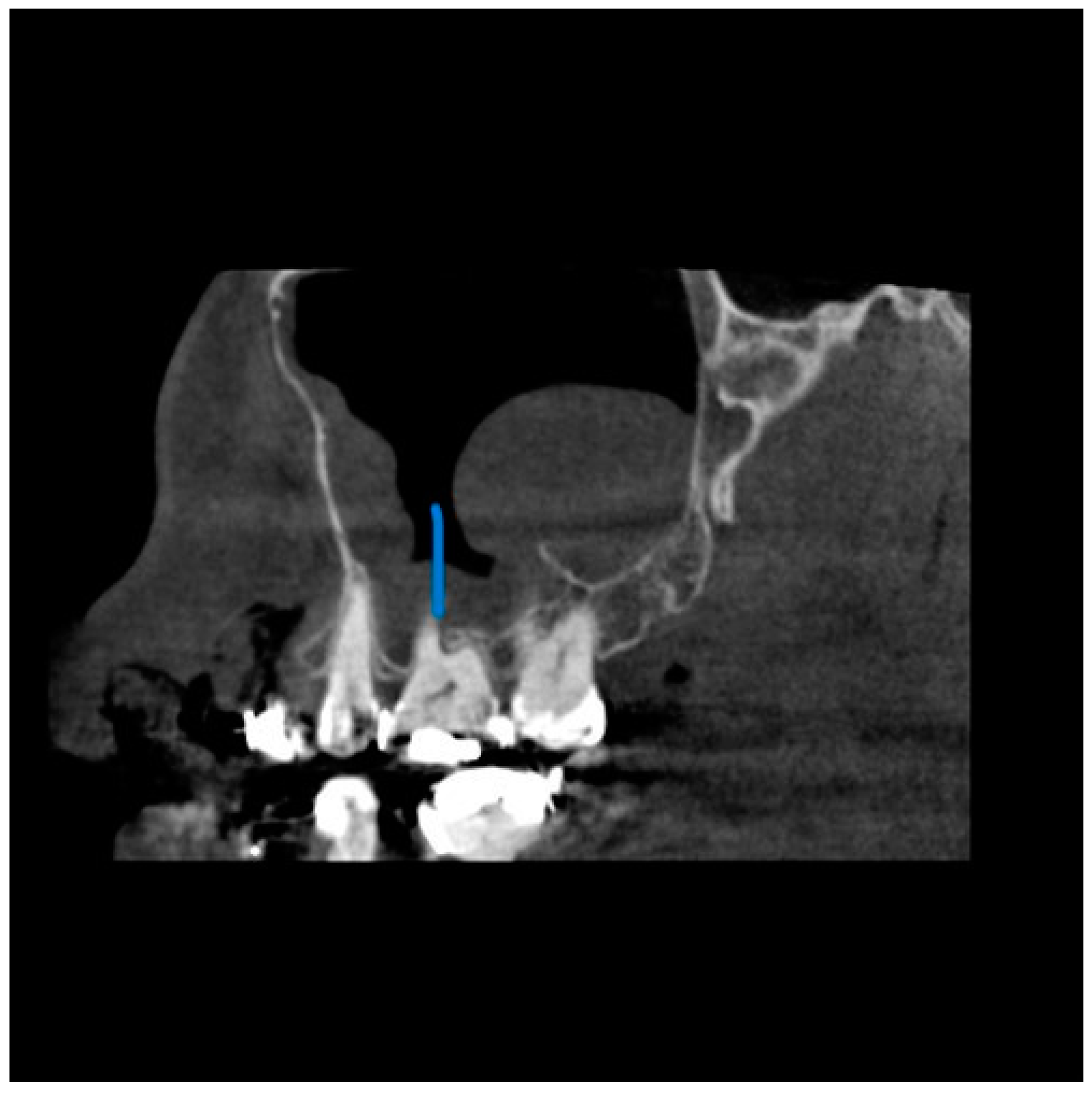 Diagnostics 13 02918 g004 Diagnostics 13 02918 g004