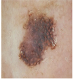 Diagnostics 13 02958 i041