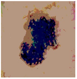 Diagnostics 13 02958 i043