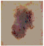 Diagnostics 13 02958 i044