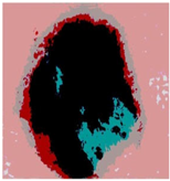 Diagnostics 13 02958 i052