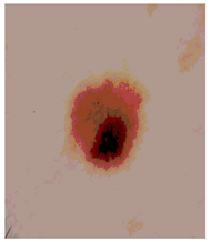 Diagnostics 13 02958 i099