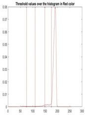 Diagnostics 13 02958 i100