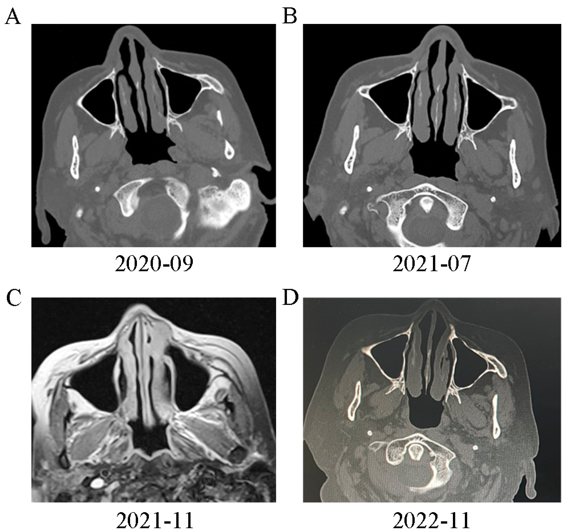 Diagnostics 13 02990 g004