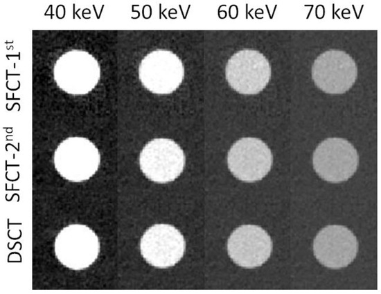 Diagnostics 13 03039 g0a2