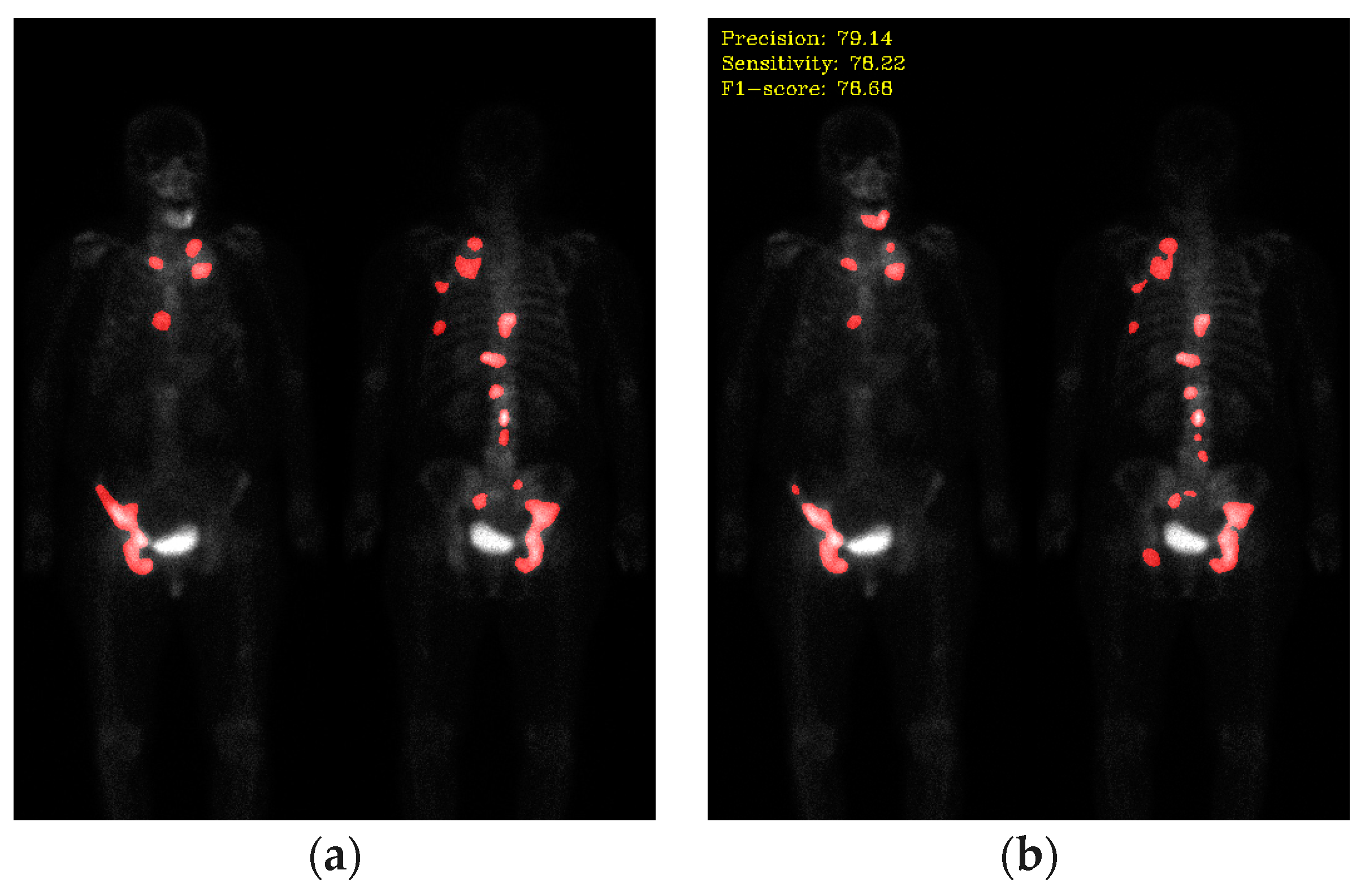 Diagnostics 13 03042 g006