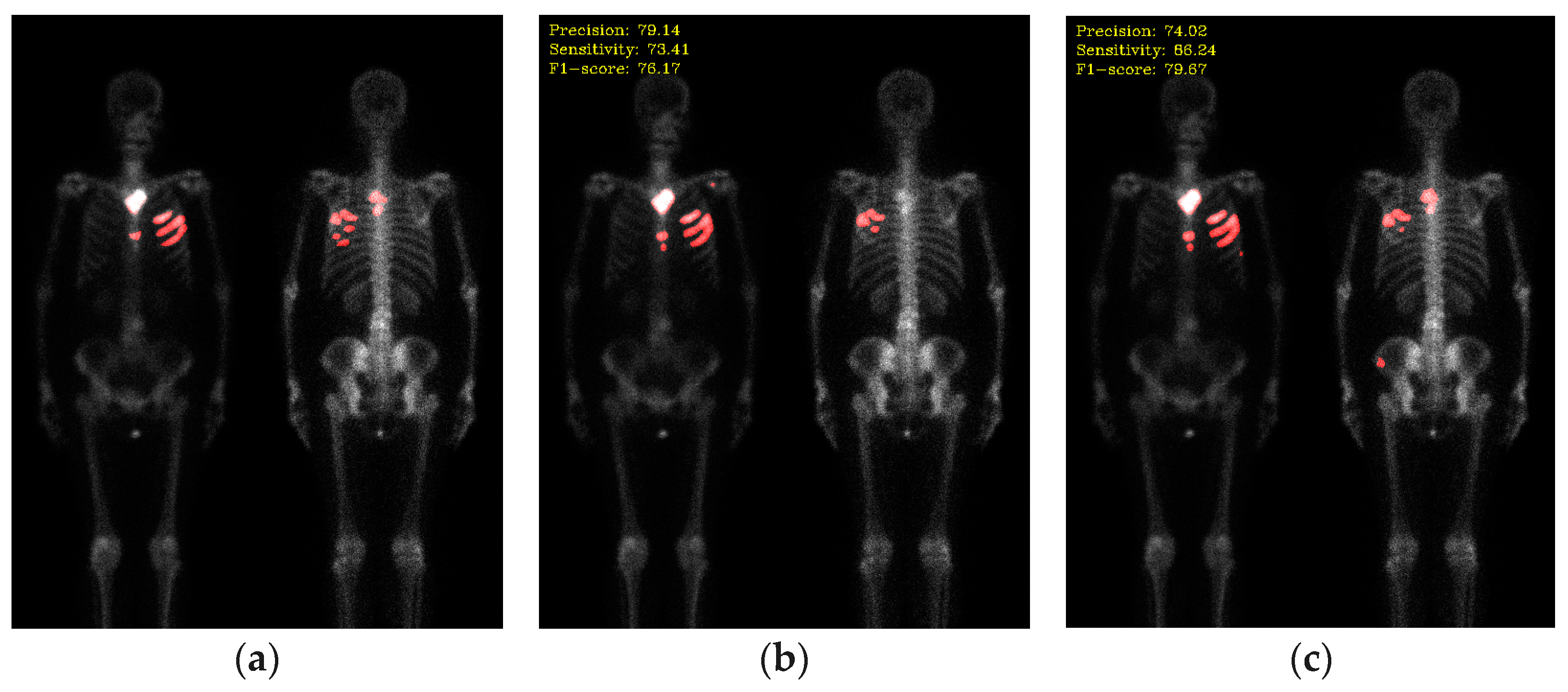Diagnostics 13 03042 g011