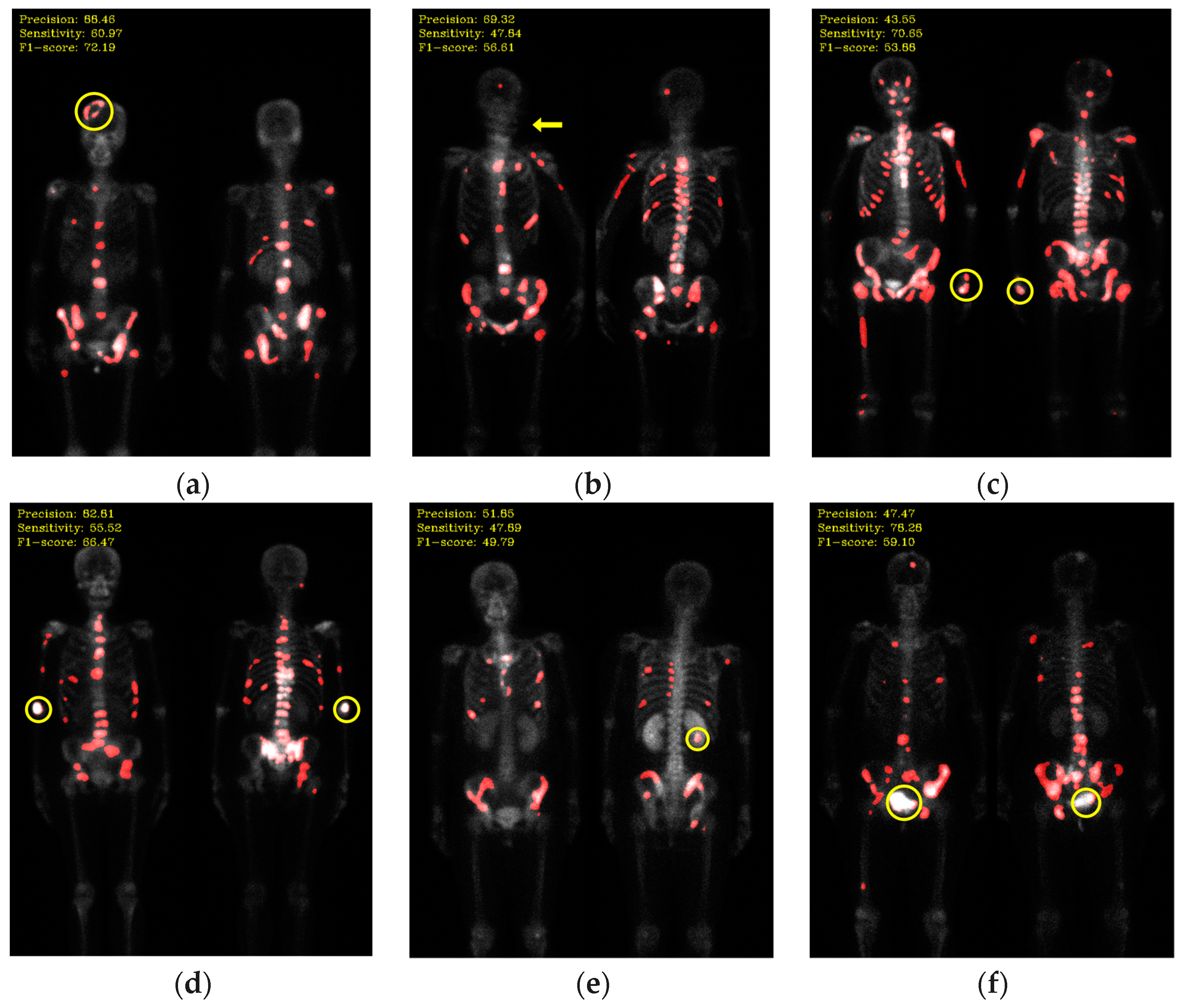 Diagnostics 13 03042 g012