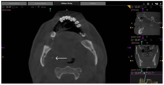 Diagnostics 13 03050 g001