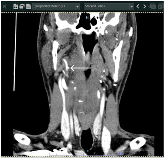 Diagnostics 13 03050 g003