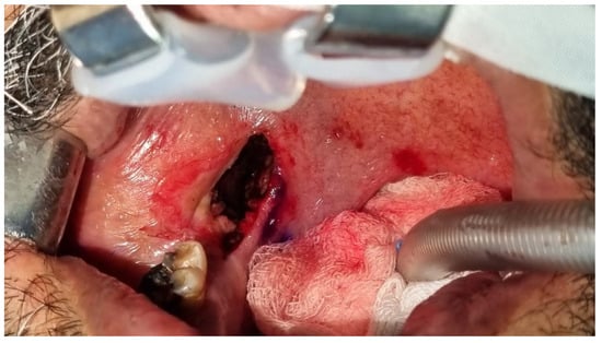 Diagnostics 13 03050 g004