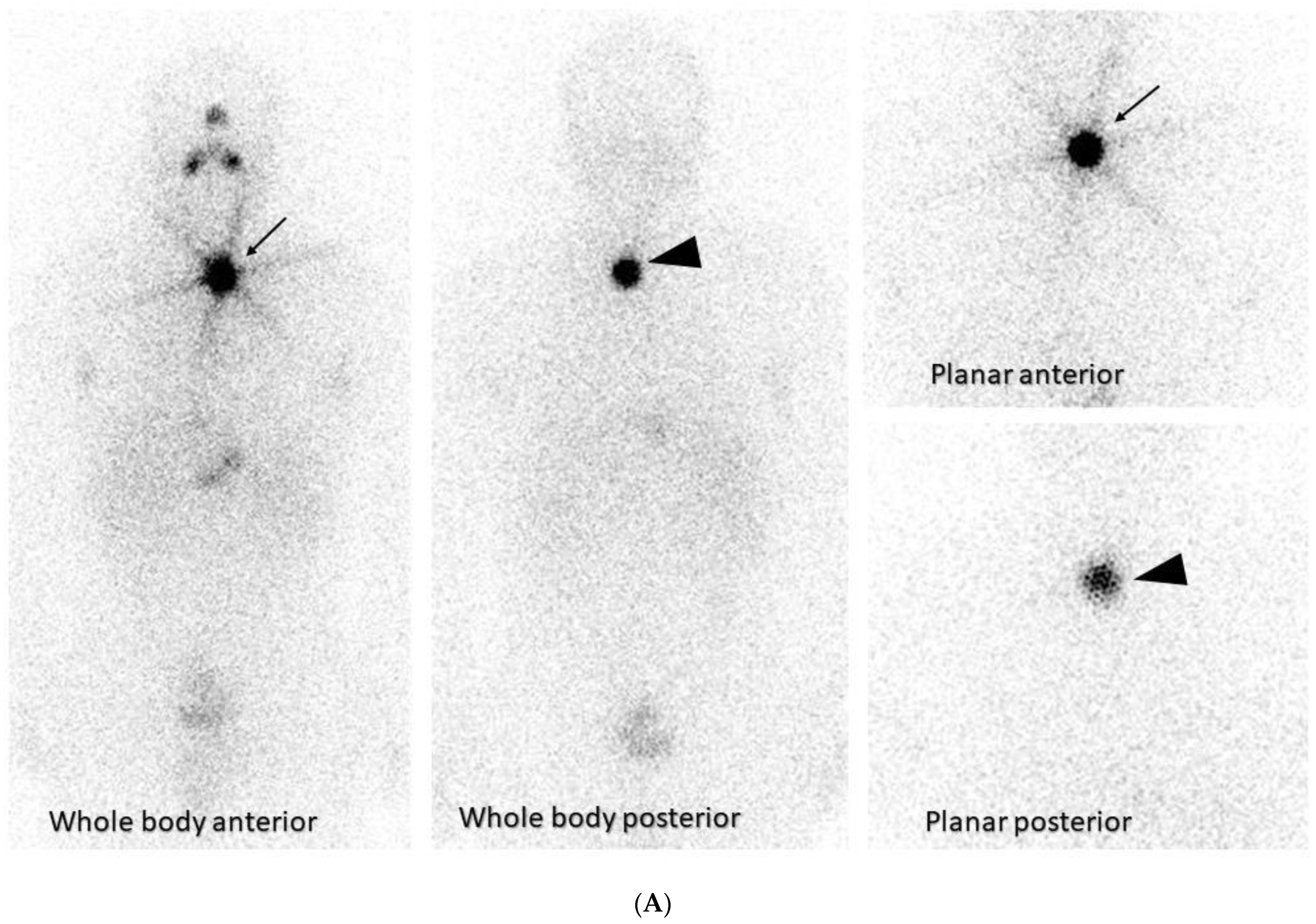 Diagnostics 13 03064 g002a