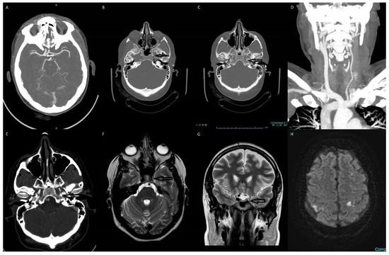 Diagnostics 13 03089 g001